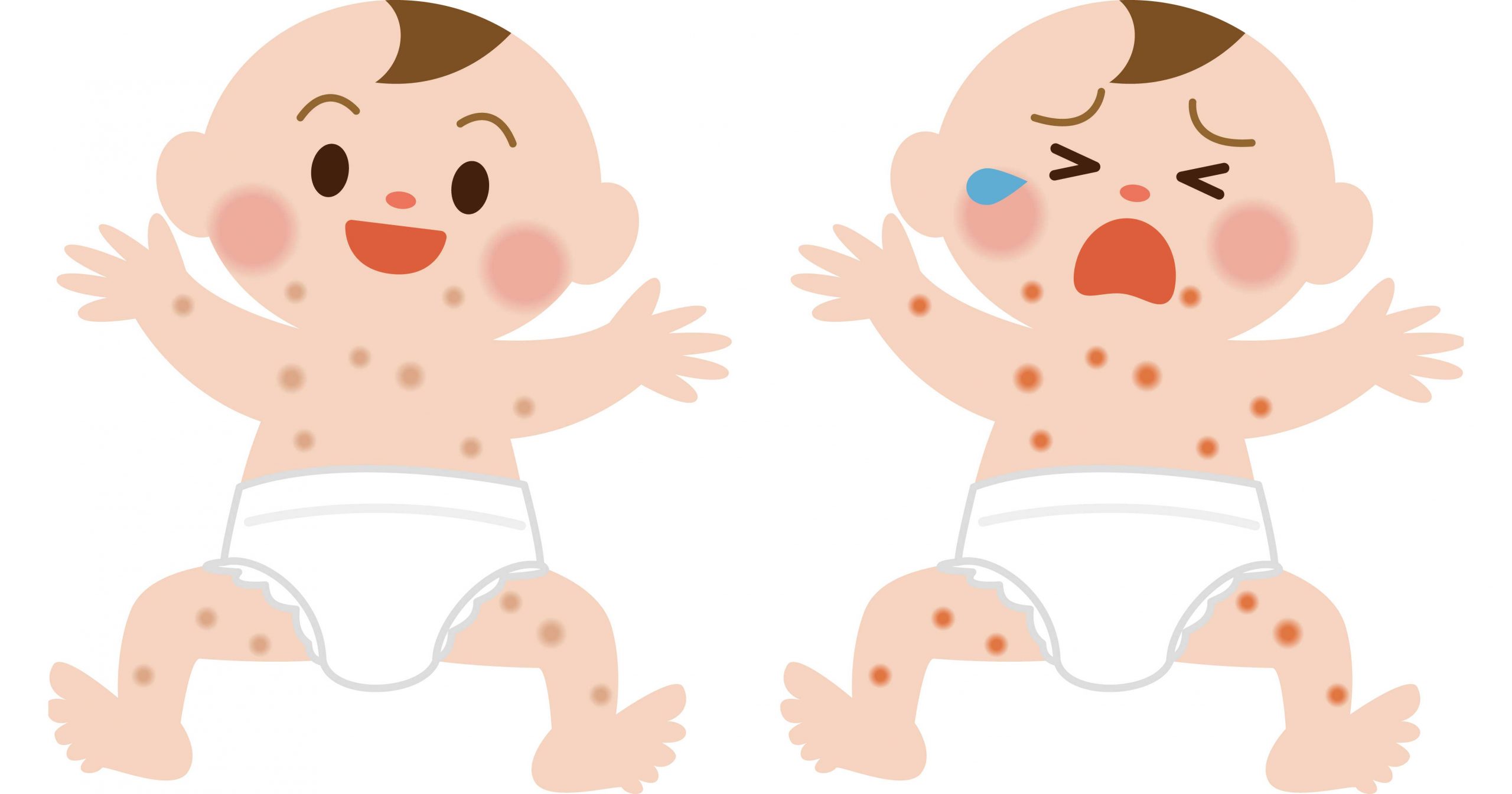 発疹が出ている赤ちゃんのイラスト